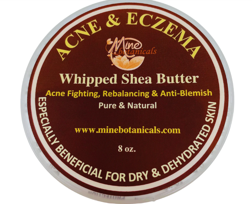 Acne & Eczema Whipped Shea Butter