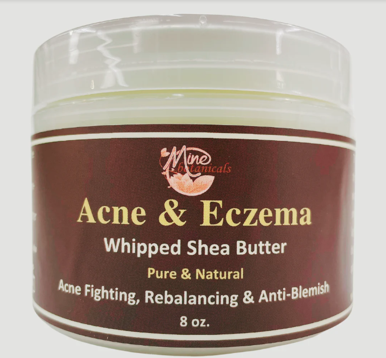 Acne & Eczema Whipped Shea Butter